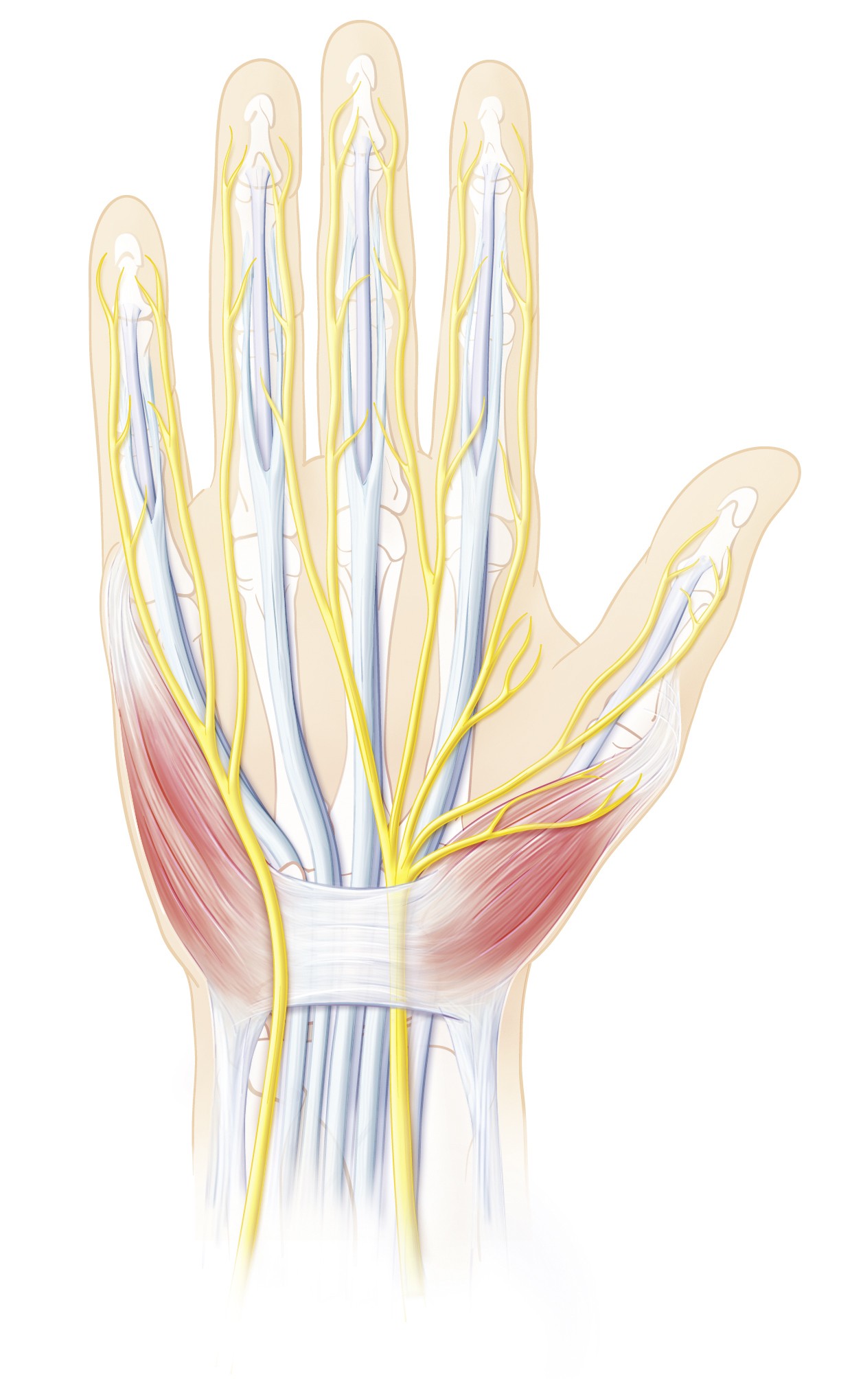 Karpaltunnelsyndrom (Carpal-Tunnel-Syndrom) | Schulthess Klinik